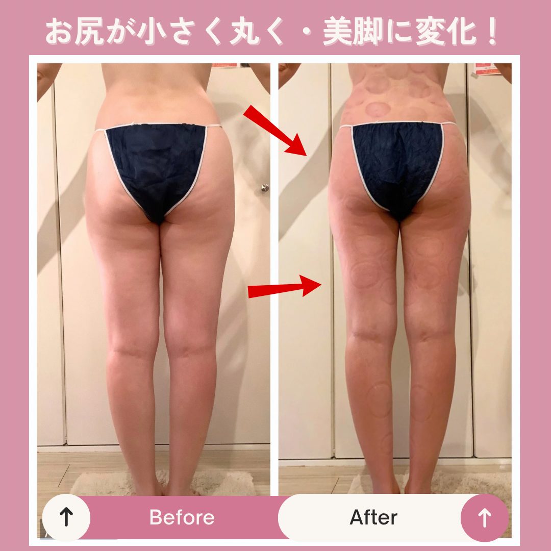 ビフォーアフター1